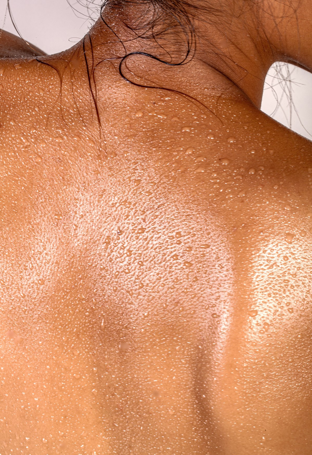 Retirada de Lipoma, Clínica Merus